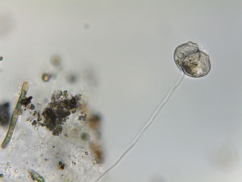 Vorticella sp. (riproduzione asessuata)